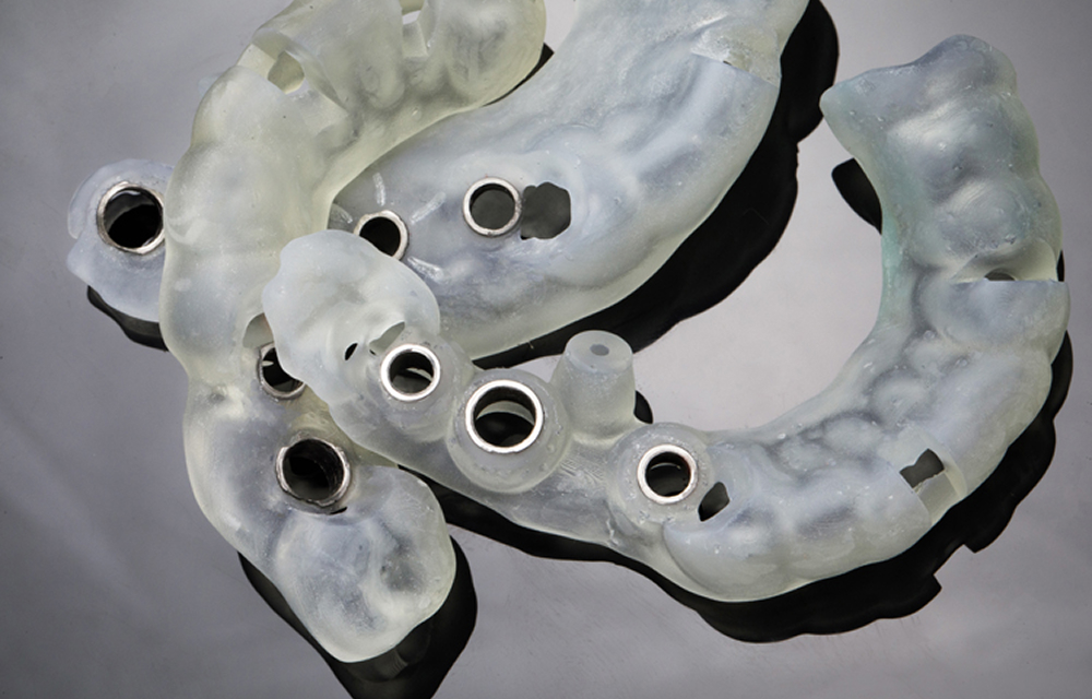 治療計画策定と事前処置・安全装置作成