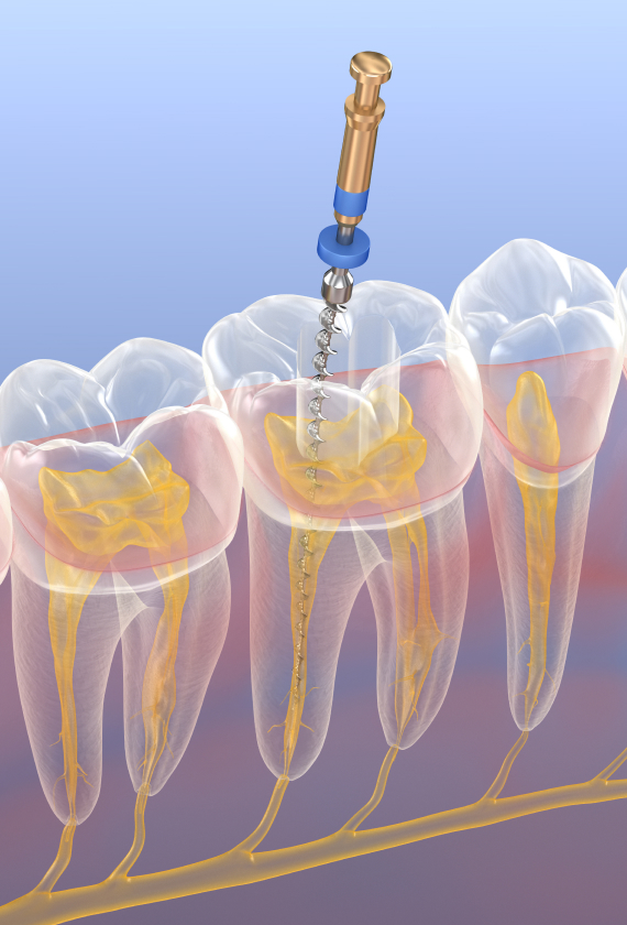 ペンエンドプログラムインジャパン（PESCJ）