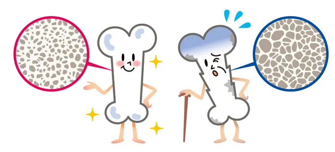 2.カルシウム不足で歯はもろくなる?