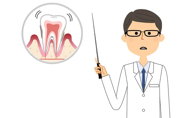 歯周病とは?