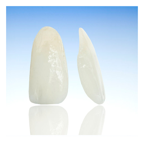 ラミネートべニア