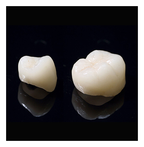 ジルコニア In/On